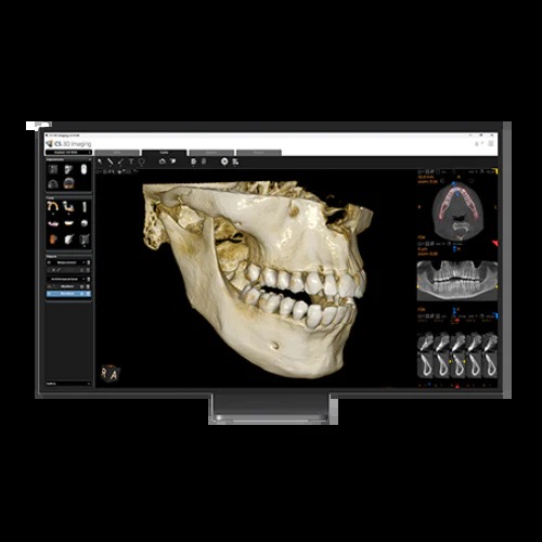 CBCT 3D Imaging